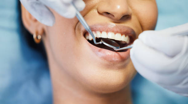 Best Chipped Tooth Repair Near Me  in Fort Myers Beach, FL