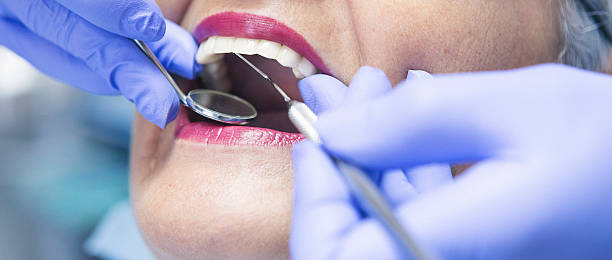 Best Chipped Tooth Repair Near Me  in Fort Myers Beach, FL